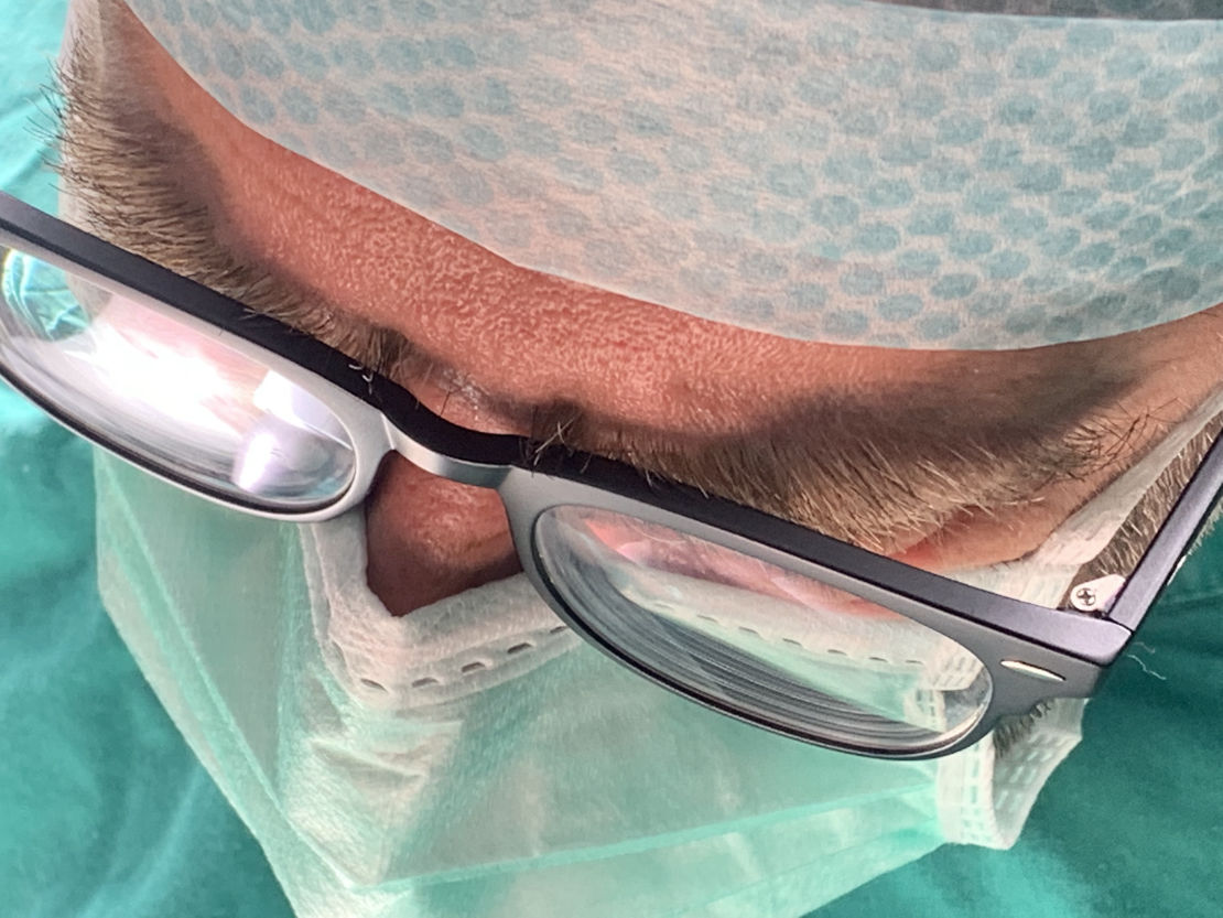 κύστη κόκκυγος